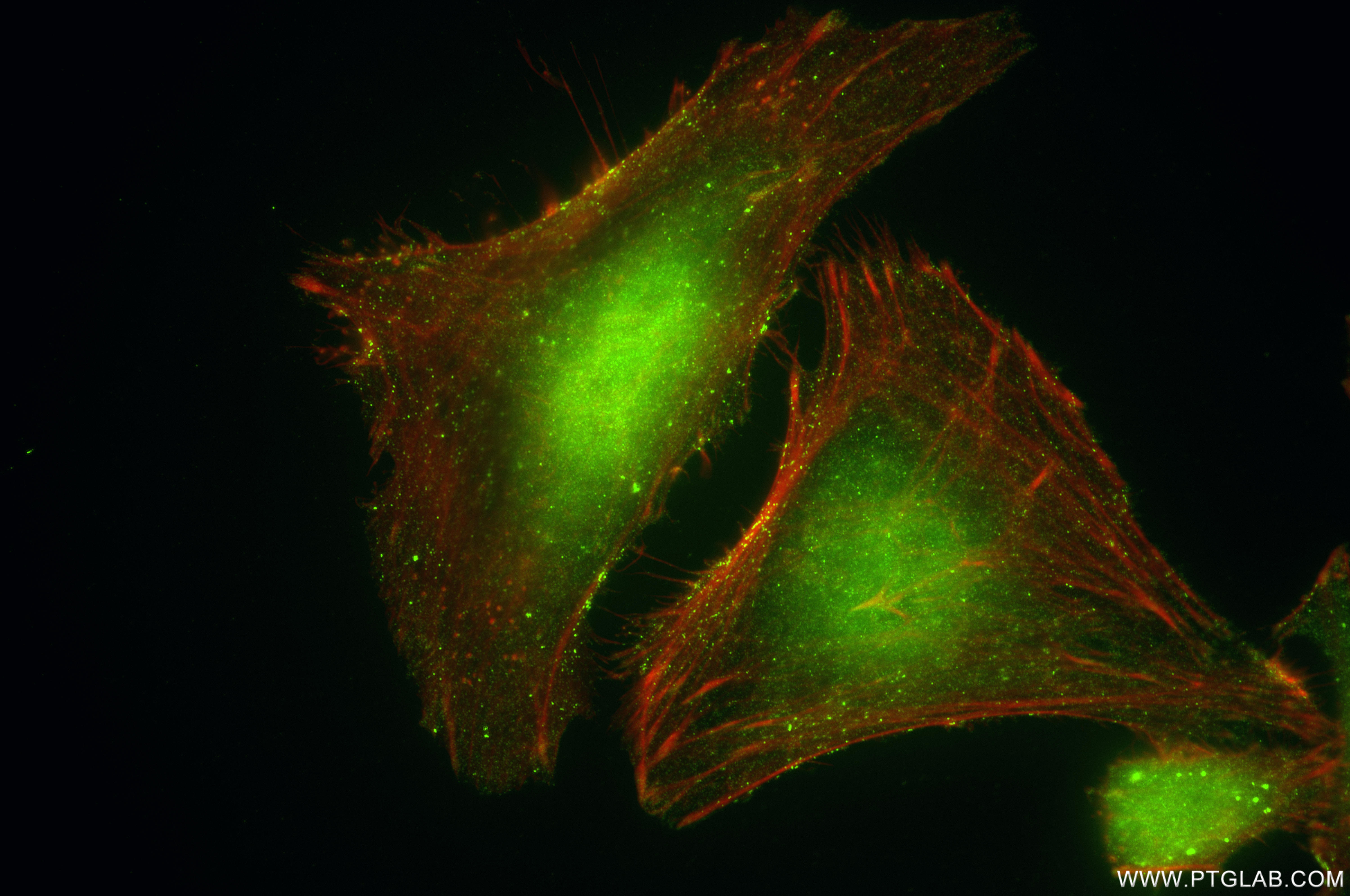 Immunofluorescent analysis of (4% PFA) fixed HeLa cells using PAK2 antibody (85646-2-RR, Clone: 243124G9 ) at dilution of 1:200 and CoraLite®488-Conjugated Goat Anti-Rabbit IgG(H+L) (<a class='green' href='/productredirect?CatalogNo=SA00013-2' target='_blank'>SA00013-2</a>), CL594-Phalloidin (red). IF Staining of HeLa using 85646-2-RR
