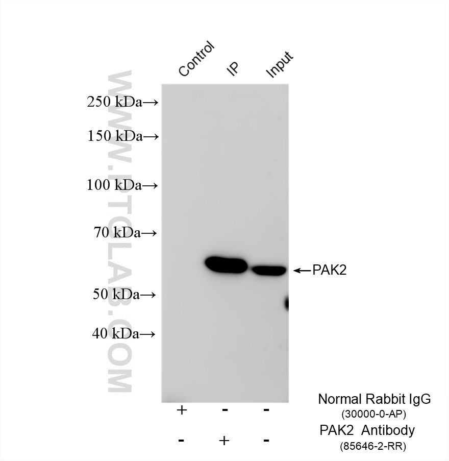 IP result of anti-PAK2 (IP:85646-2-RR, 4ug; Detection:85646-2-RR 1:1000) with HeLa cells lysate 920 ug. IP experiment of HeLa using 85646-2-RR