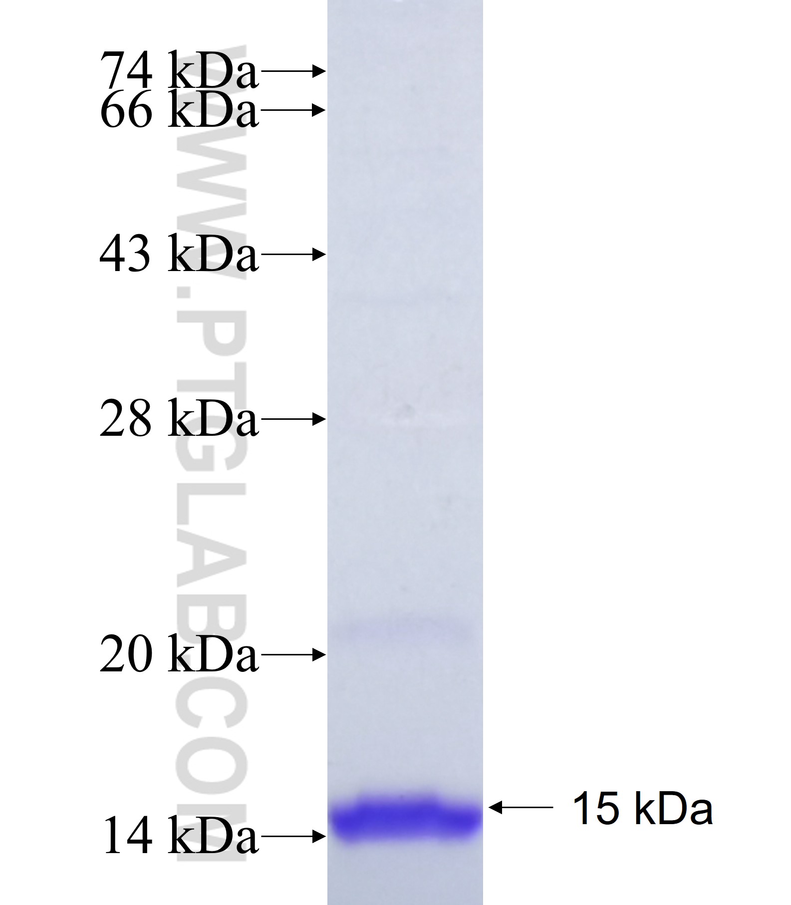 PAK3 fusion protein Ag38284 SDS-PAGE PAK3 fusion protein Ag38284 SDS-PAGE