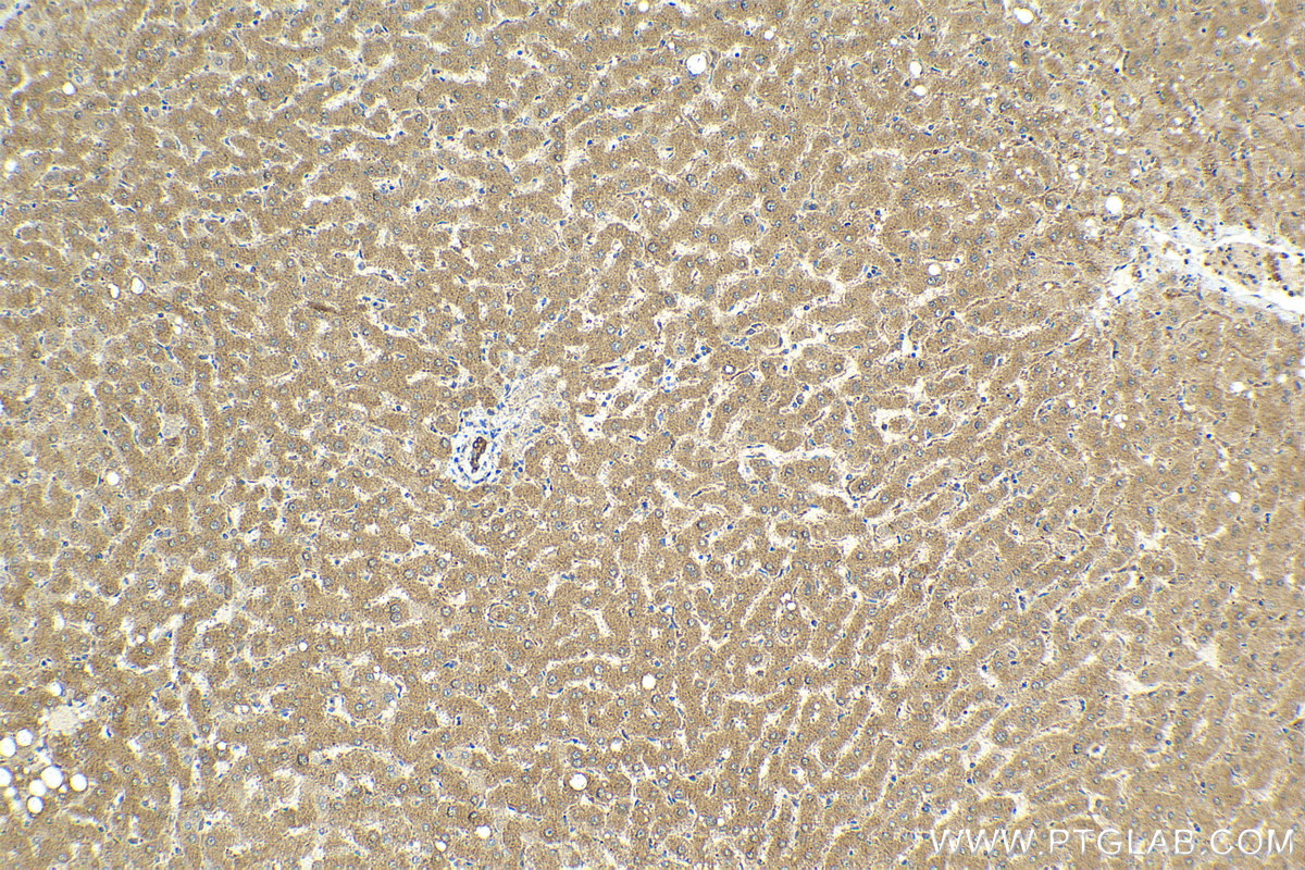 IHC staining of human liver using 14685-1-AP