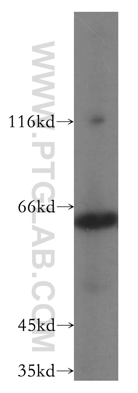 WB analysis of COLO 320 using 14685-1-AP