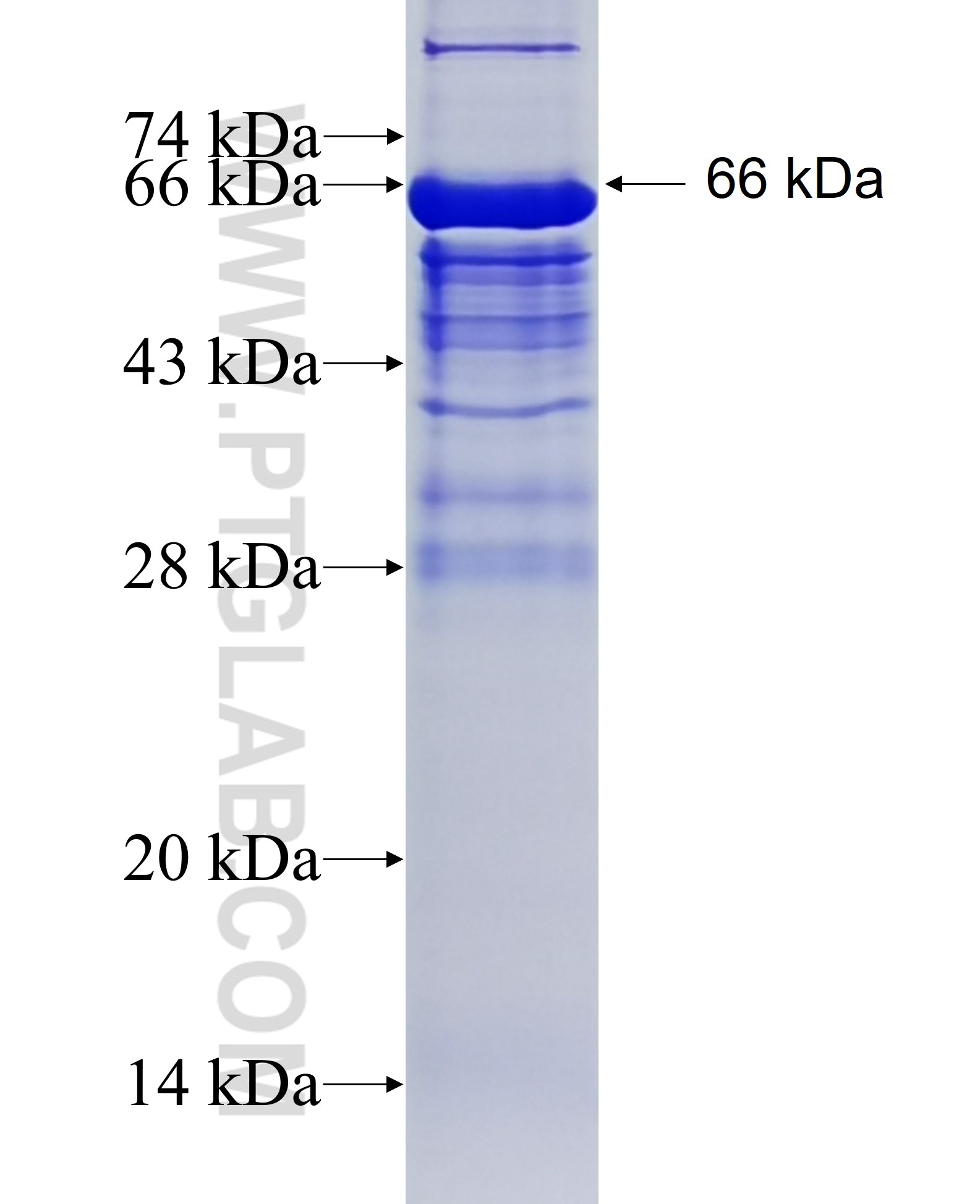 PAK4 fusion protein Ag5981 SDS-PAGE