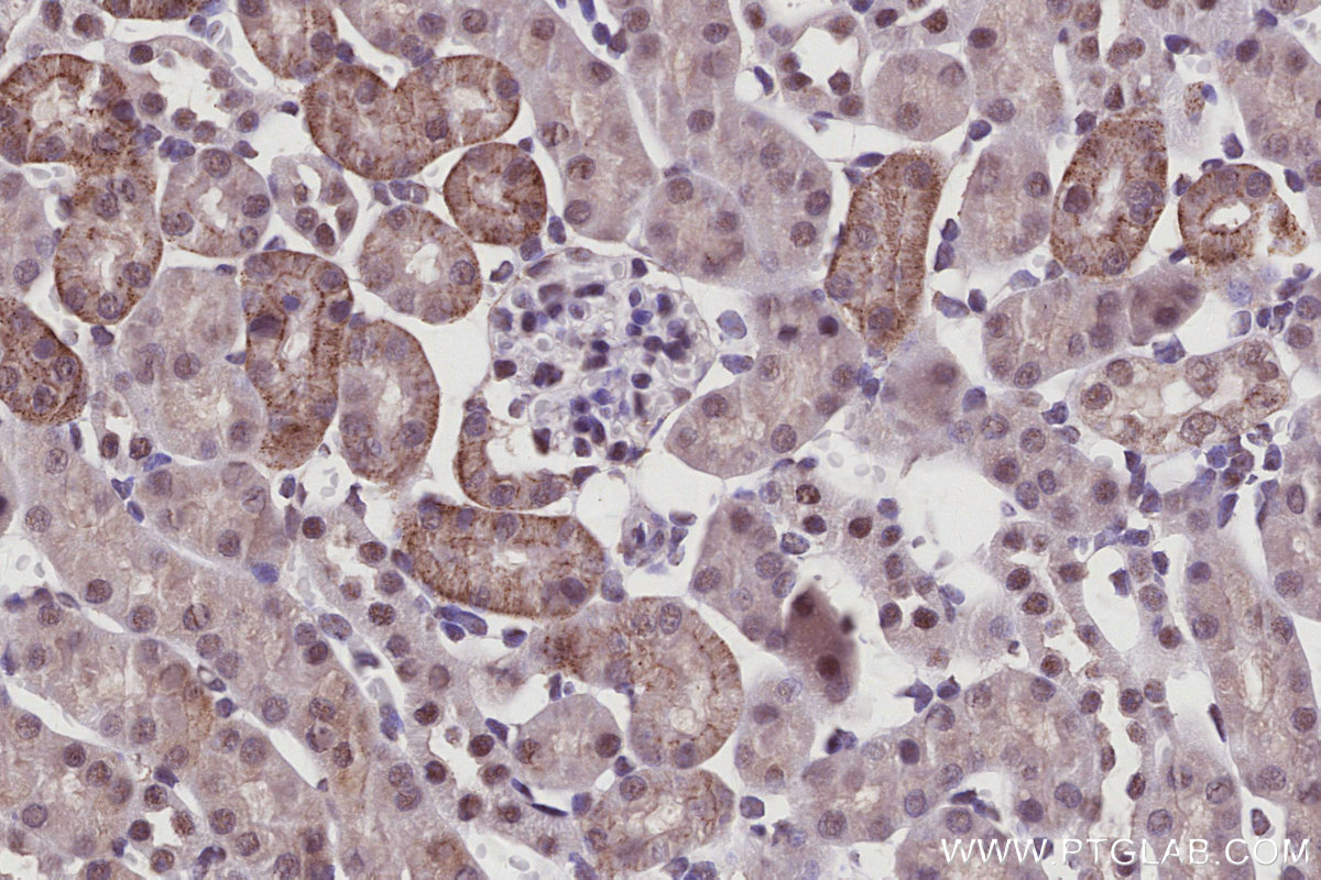 IHC staining of mouse kidney using 67562-1-Ig IHC staining of mouse kidney using 67562-1-Ig