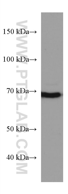 WB analysis of K-562 using 67562-1-Ig