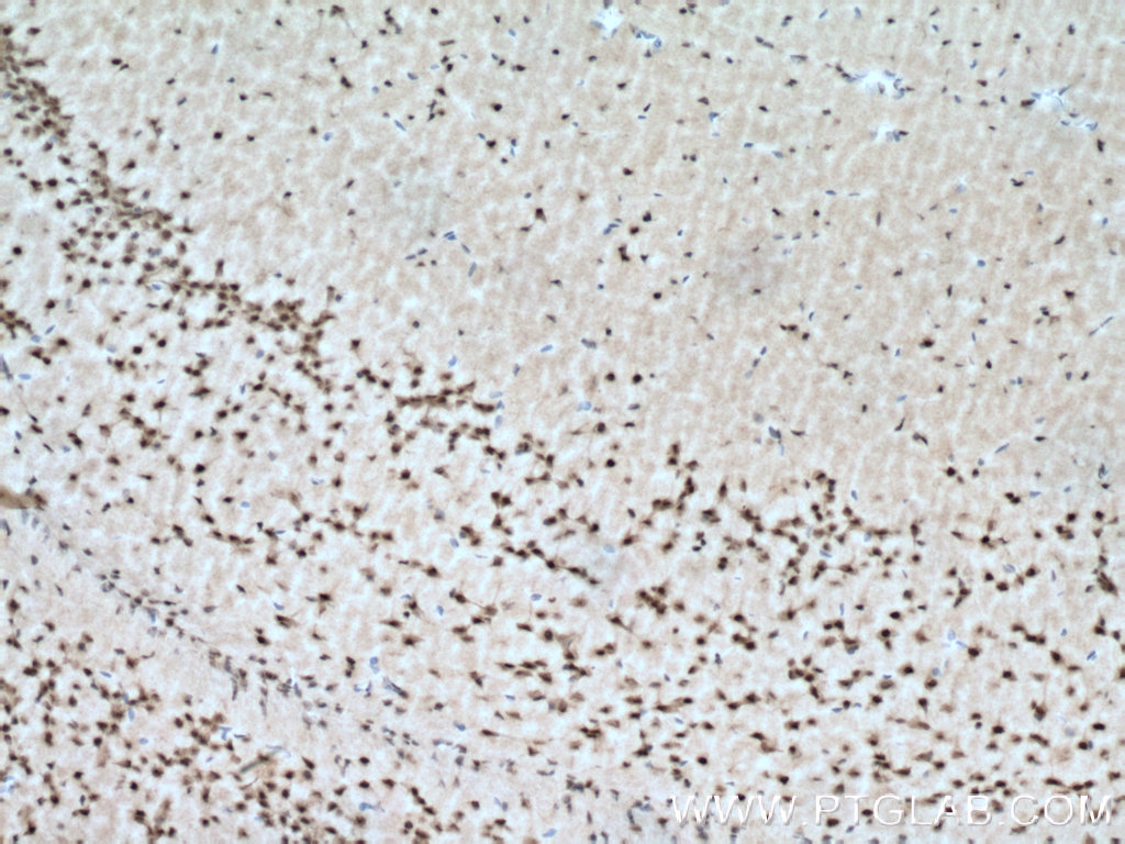 IHC staining of mouse brain using 12460-1-AP (same clone as 12460-1-PBS)