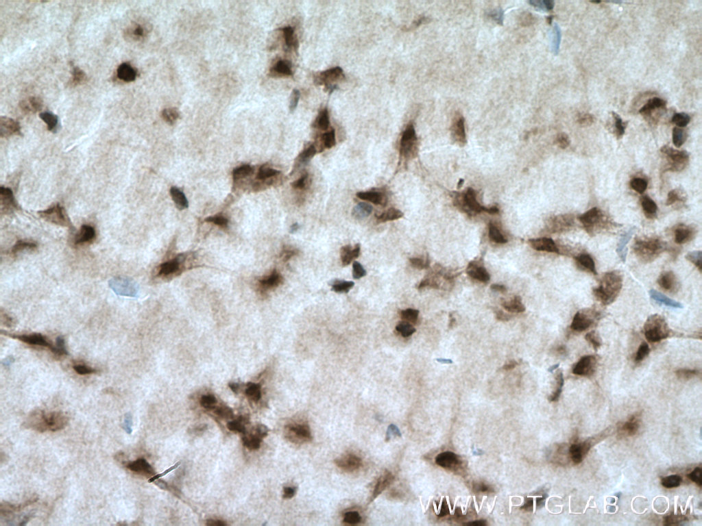 IHC staining of mouse brain using 12460-1-AP