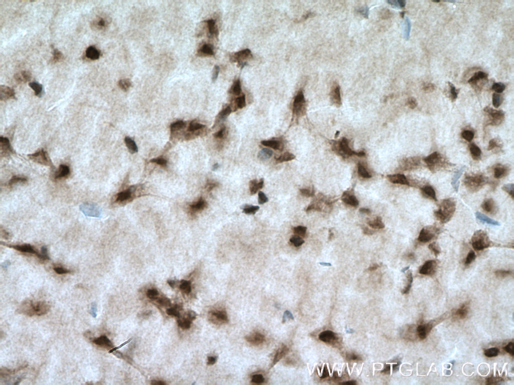 IHC staining of mouse brain using 12460-1-AP (same clone as 12460-1-PBS)