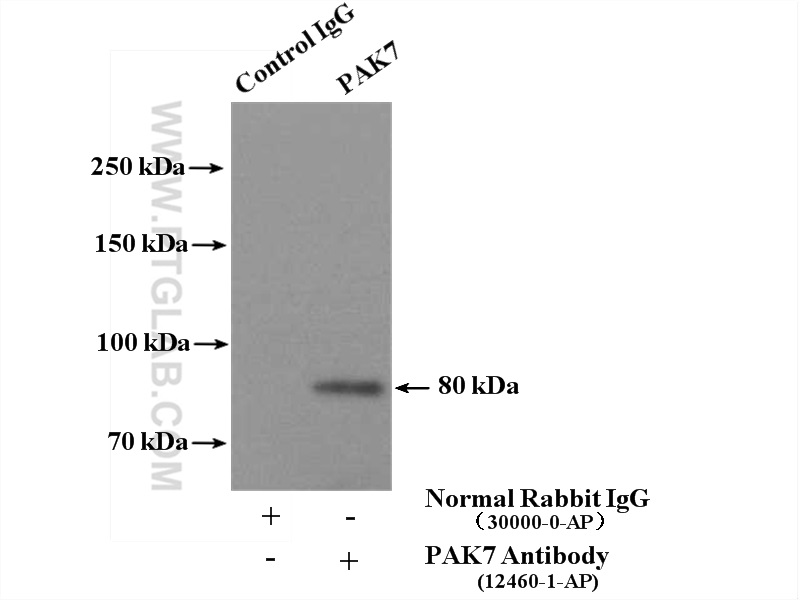 IP experiment of mouse brain using 12460-1-AP (same clone as 12460-1-PBS)