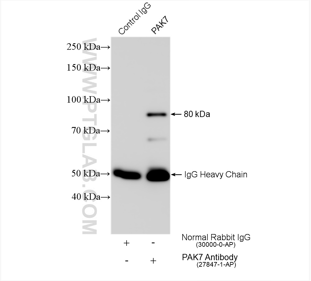 IP experiment of mouse brain using 27847-1-AP