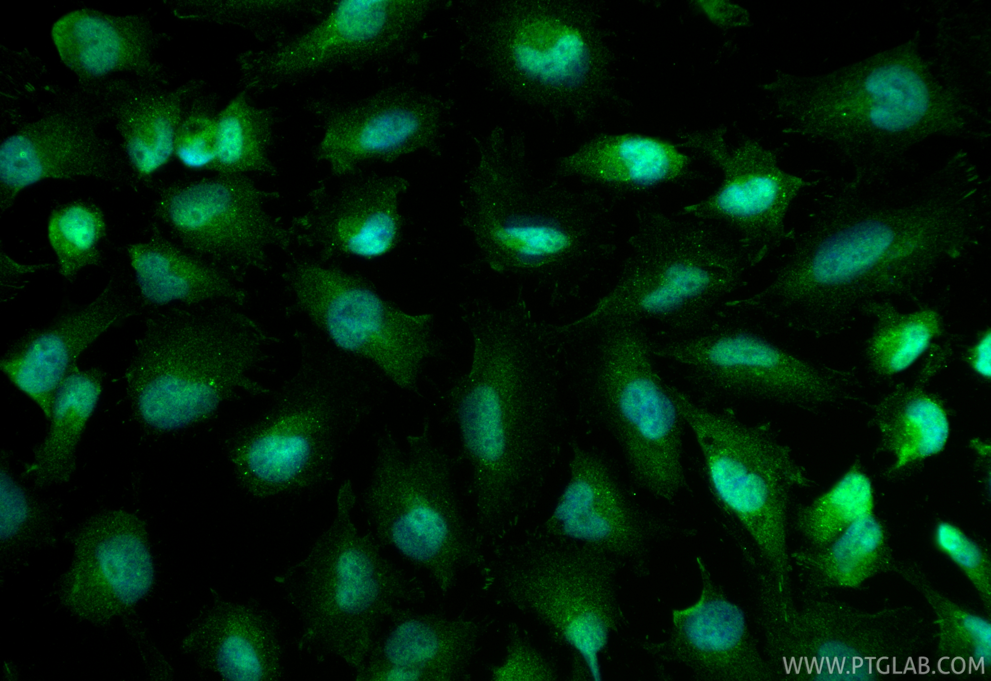 IF Staining of U-251 using 32085-1-AP (same clone as 32085-1-PBS) IF Staining of U-251 using 32085-1-AP (same clone as 32085-1-PBS)