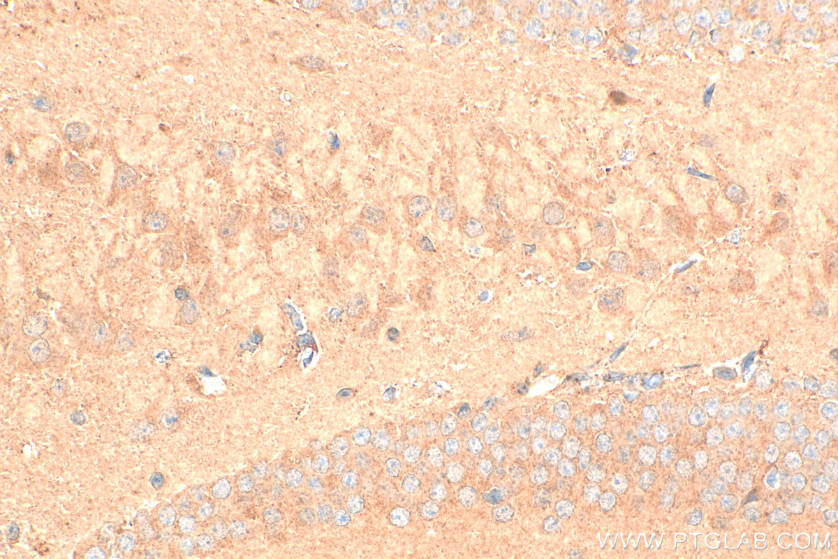 IHC staining of mouse brain using 32085-1-AP (same clone as 32085-1-PBS) IHC staining of mouse brain using 32085-1-AP (same clone as 32085-1-PBS)