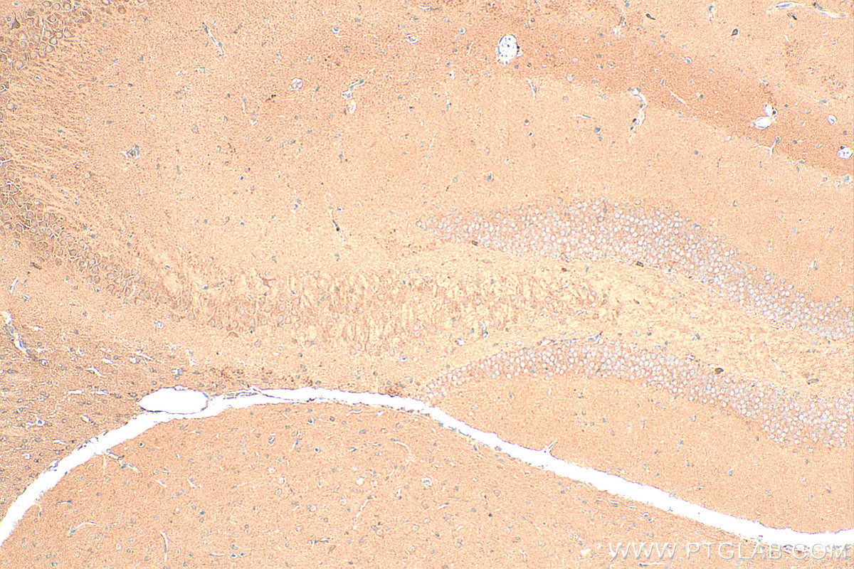 IHC staining of mouse brain using 32085-1-AP (same clone as 32085-1-PBS) IHC staining of mouse brain using 32085-1-AP (same clone as 32085-1-PBS)