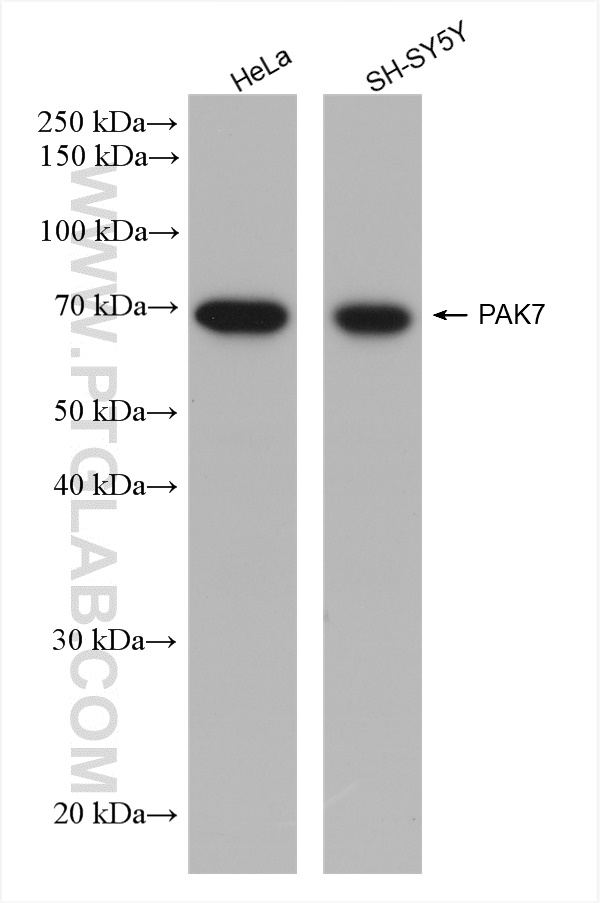 WB analysis using 82935-1-RR (same clone as 82935-1-PBS)