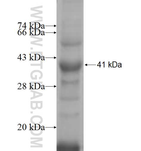 PALB2 fusion protein Ag5995 SDS-PAGE PALB2 fusion protein Ag5995 SDS-PAGE