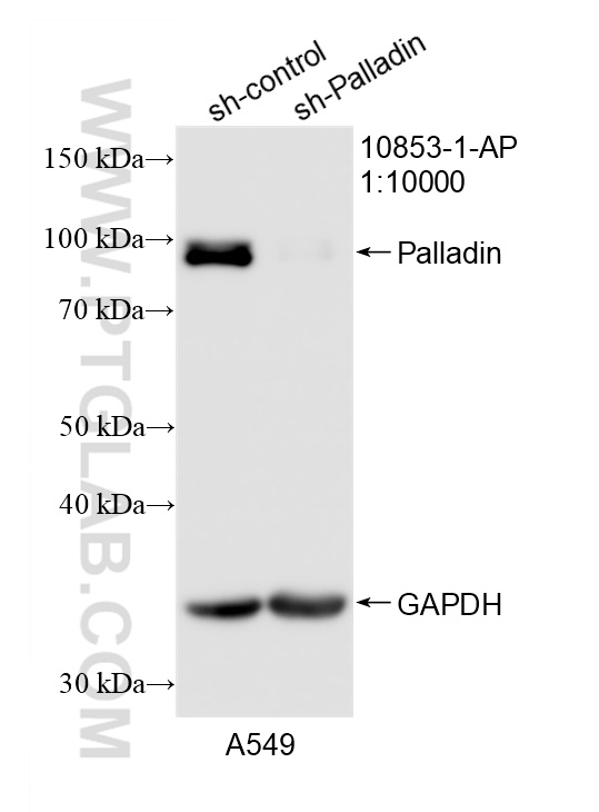 WB analysis of A549 using 10853-1-AP