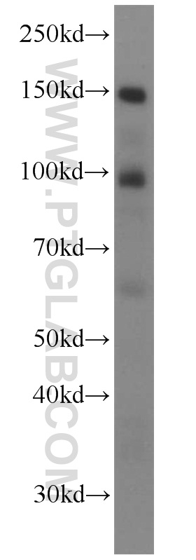 WB analysis of HeLa using 10853-1-AP