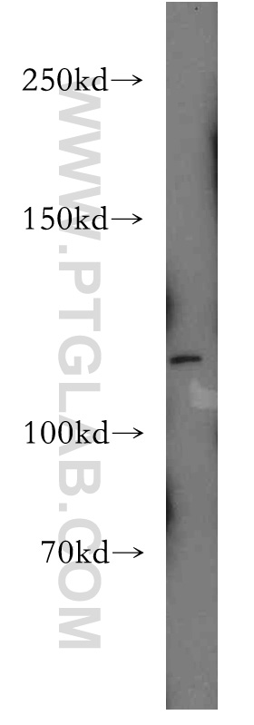 WB analysis of HeLa using 16179-1-AP