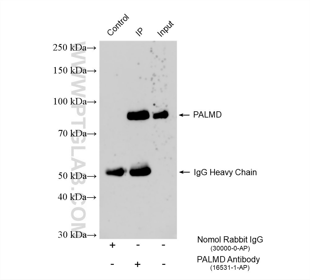 IP experiment of HeLa using 16531-1-AP