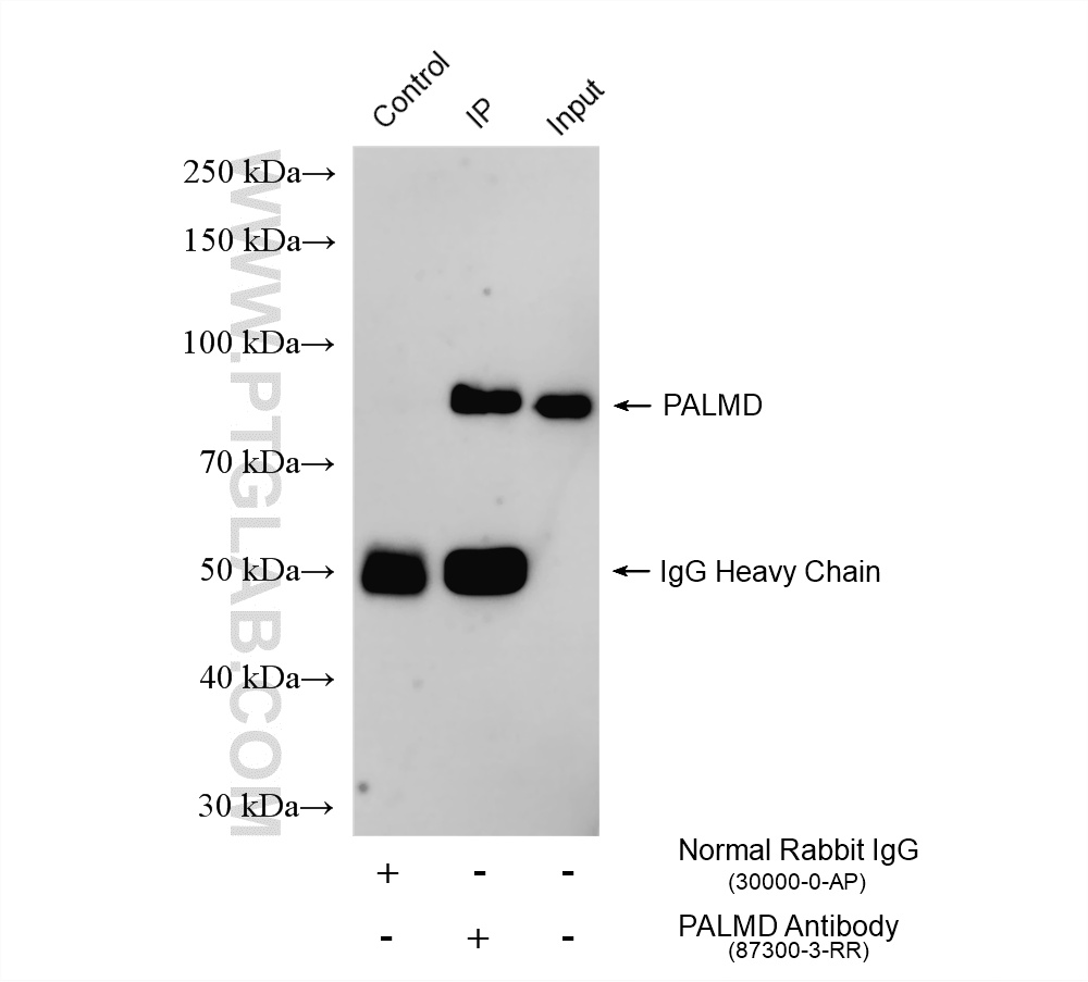 IP result of anti-PALMD (IP:<a class='green' href='/productredirect?CatalogNo=87300-3-RR' target='_blank'>87300-3-RR</a>, 4ug; Detection:<a class='green' href='/productredirect?CatalogNo=87300-3-RR' target='_blank'>87300-3-RR</a> 1:2000) with HeLa cells lysate 1320 ug. This data was developed using the same antibody clone with 87300-3-PBS in a different storage buffer formulation. IP experiment of HeLa using 87300-3-RR (same clone as 87300-3-PBS)