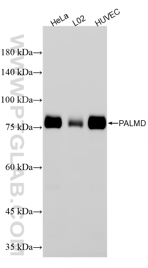 Various lysates were subjected to SDS PAGE followed by western blot with <a class='green' href='/productredirect?CatalogNo=87300-3-RR' target='_blank'>87300-3-RR</a> (PALMD antibody) at dilution of 1:10000 incubated at room temperature for 1.5 hours. This data was developed using the same antibody clone with 87300-3-PBS in a different storage buffer formulation. WB analysis using 87300-3-RR (same clone as 87300-3-PBS)