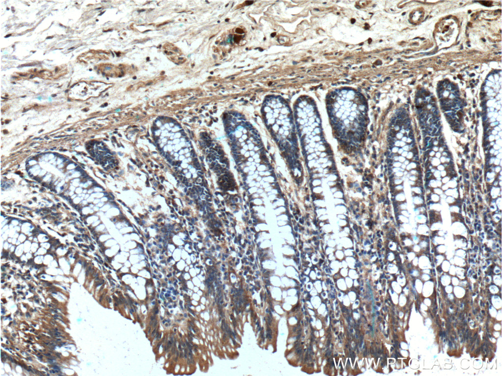 IHC staining of human colon using 26972-1-AP