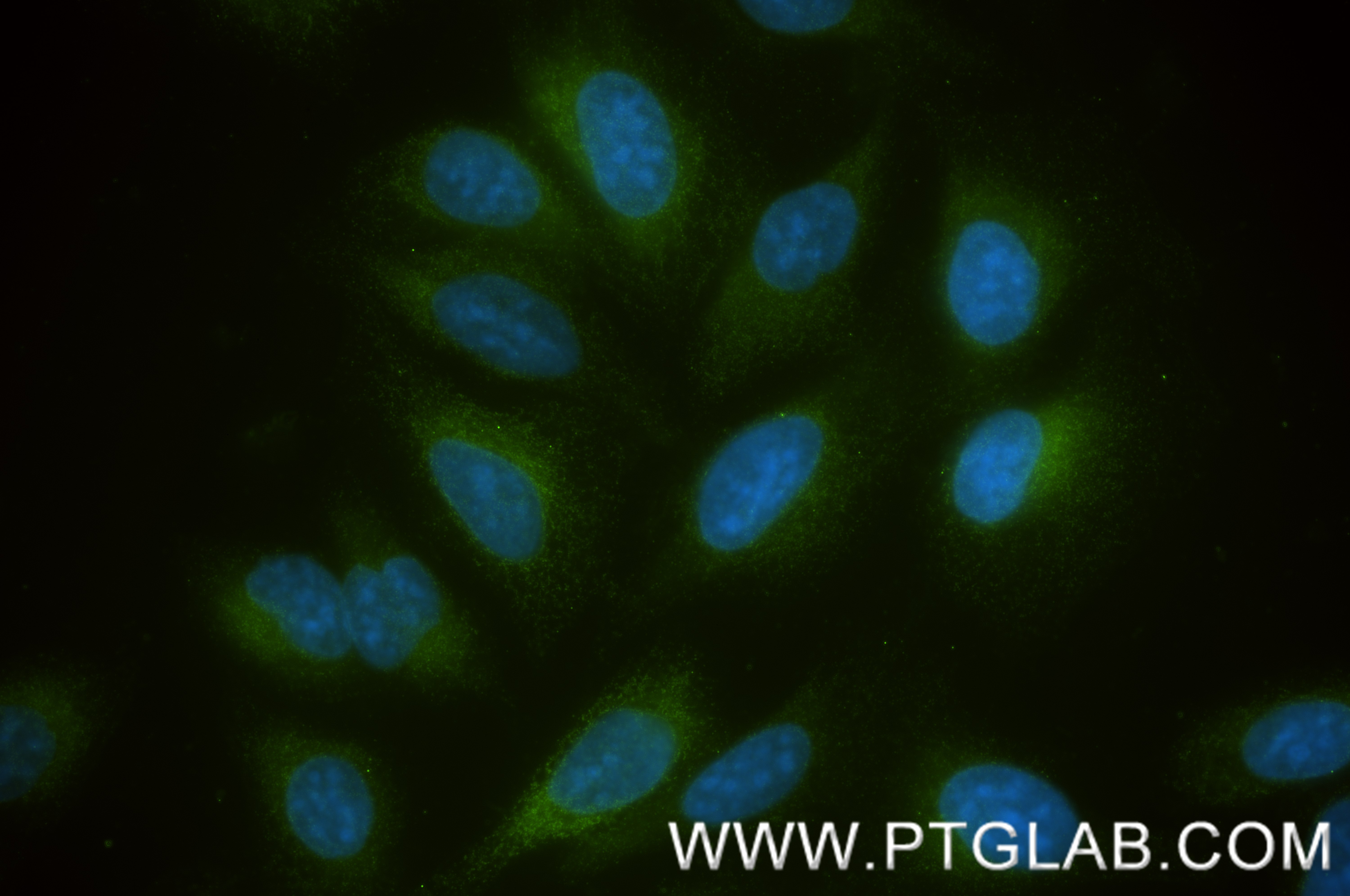IF Staining of U2OS using 87921-1-RR IF Staining of U2OS using 87921-1-RR