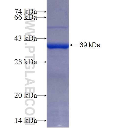 PAM fusion protein Ag25732 SDS-PAGE PAM fusion protein Ag25732 SDS-PAGE