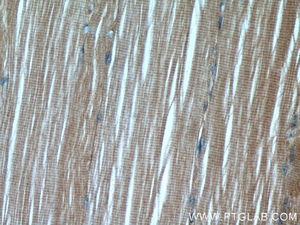 IHC staining of human skeletal muscle using 55310-1-AP