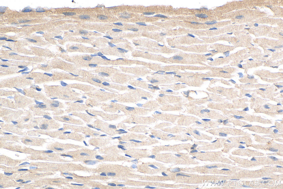 IHC staining of mouse heart using 16427-1-AP