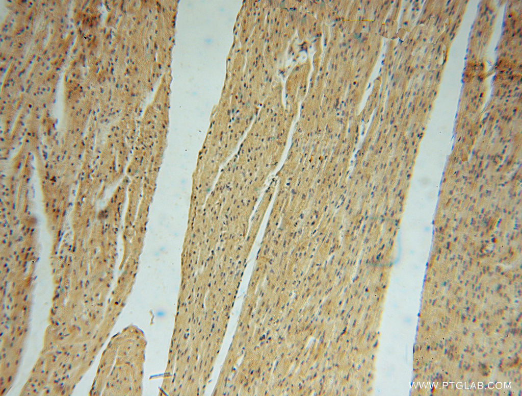 IHC staining of human heart using 16427-1-AP