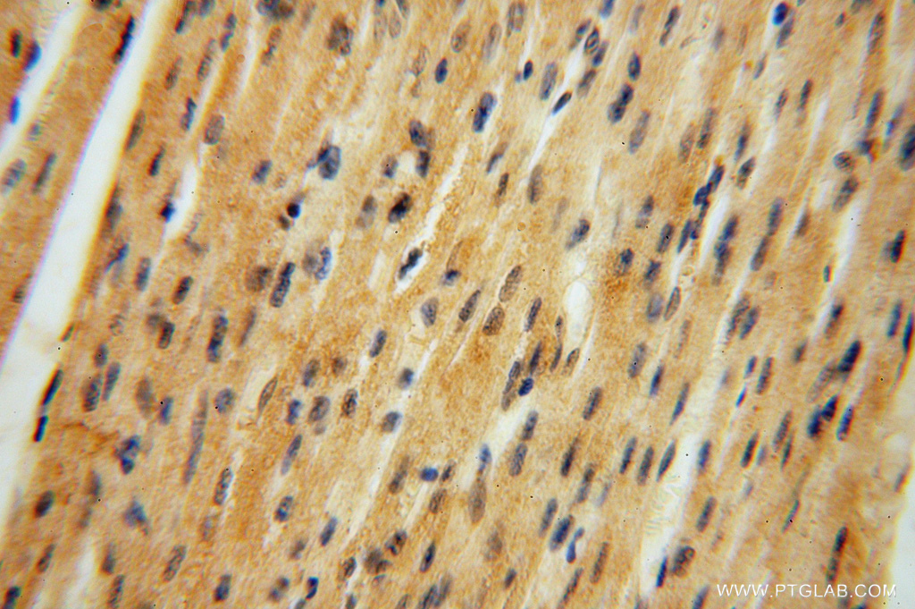 IHC staining of human heart using 16427-1-AP