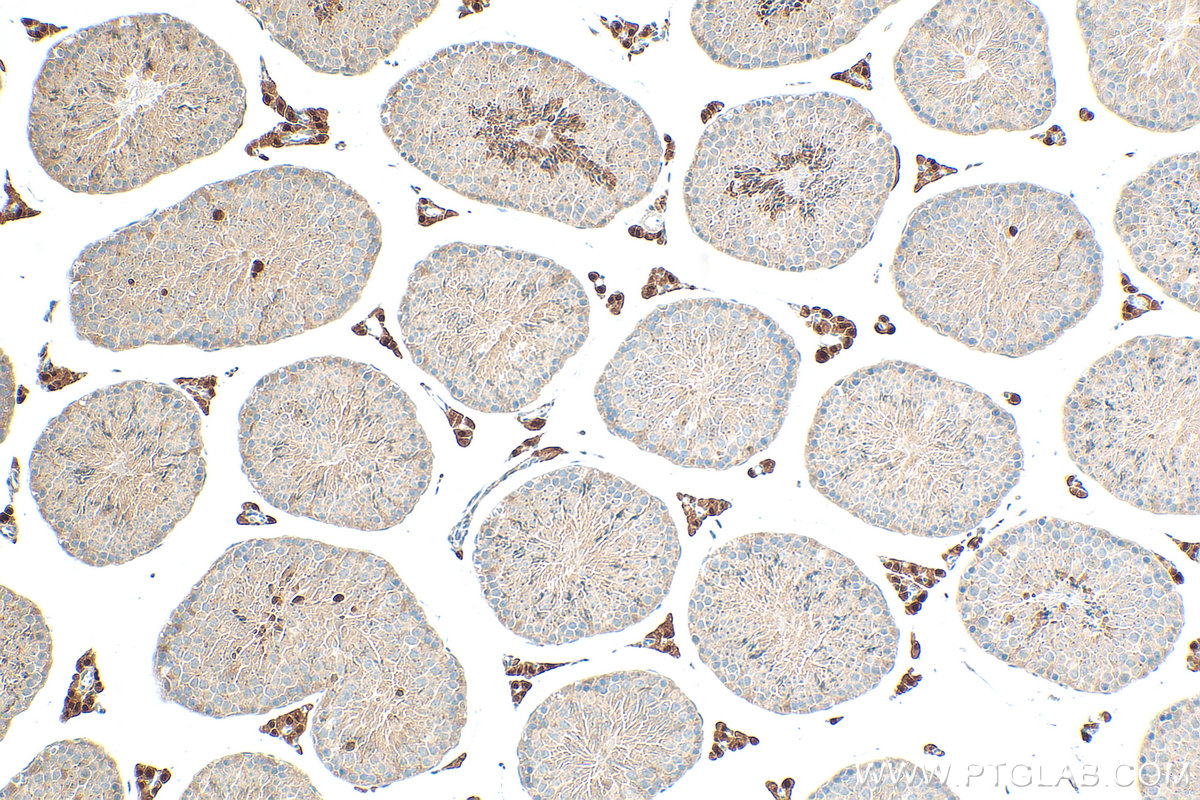 IHC staining of mouse testis using 11768-1-AP
