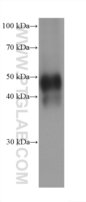 Neuro-2a cells were subjected to SDS PAGE followed by western blot with 68873-5-Ig (PANX1 antibody) at dilution of 1:20000 incubated at room temperature for 1.5 hours. WB analysis of Neuro-2a using 68873-5-Ig