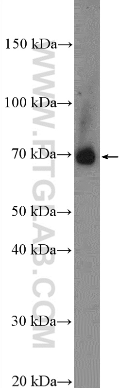 WB analysis of mouse lung using 26604-1-AP