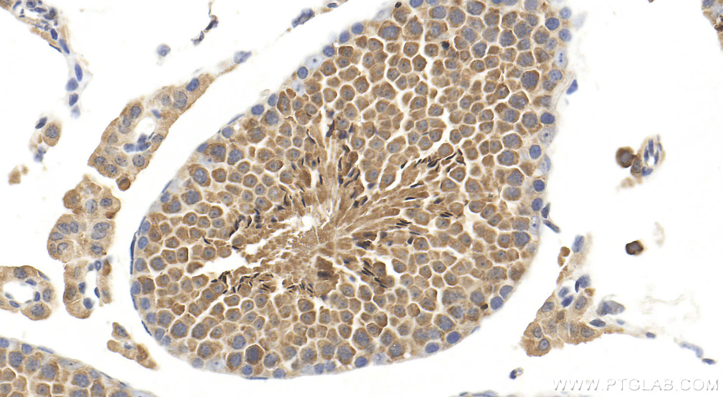 IHC staining of mouse testis using 18972-1-AP