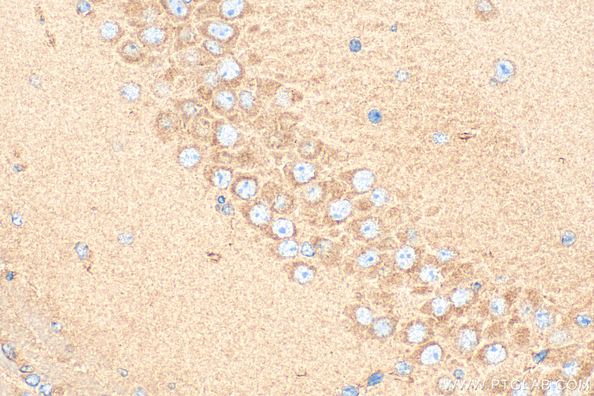 IHC staining of mouse brain using 18842-1-AP
