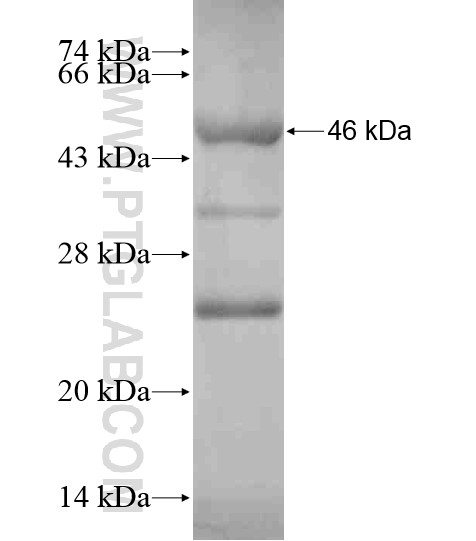PAPD4 fusion protein Ag18599 SDS-PAGE PAPD4 fusion protein Ag18599 SDS-PAGE