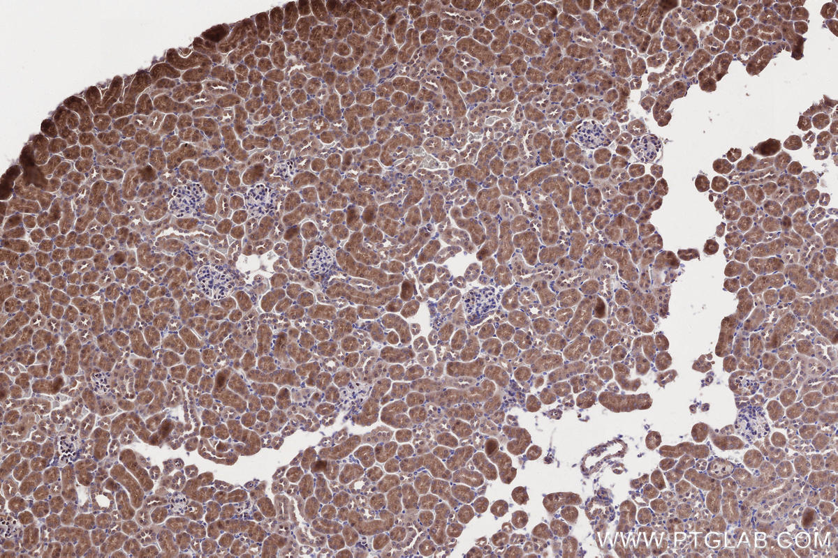 IHC staining of mouse kidney using 55197-1-AP