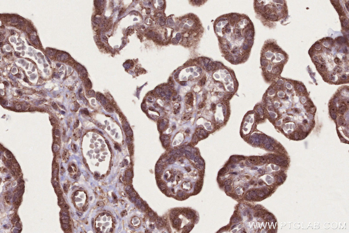 IHC staining of human placenta using 55197-1-AP