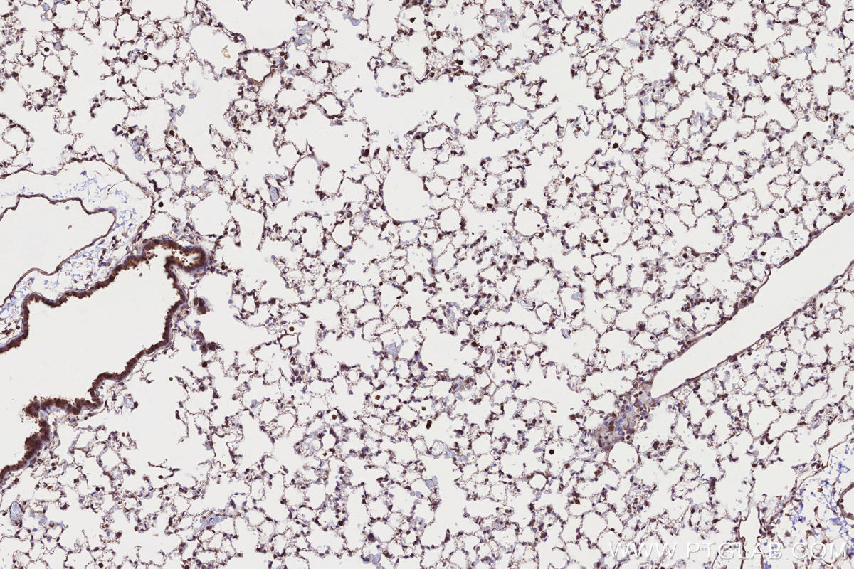 IHC staining of mouse lung using 55197-1-AP