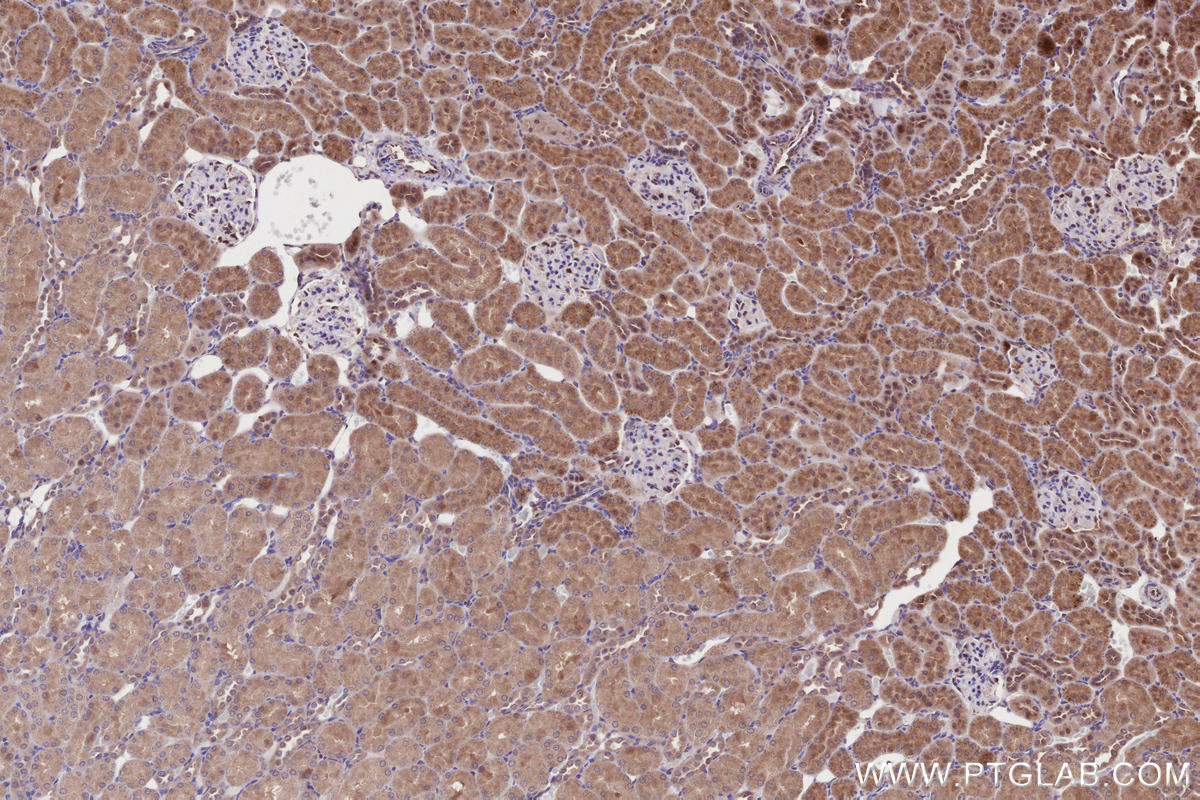 IHC staining of rat kidney using 55197-1-AP