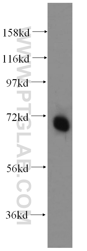 WB analysis of mouse testis using 12821-1-AP