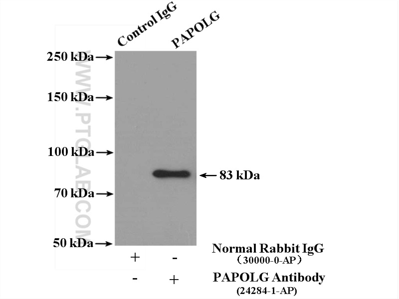 IP experiment of HeLa using 24284-1-AP