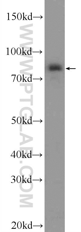 WB analysis of HeLa using 24284-1-AP