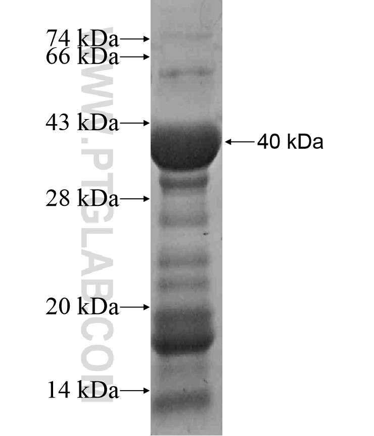 PAPOLG fusion protein Ag16998 SDS-PAGE PAPOLG fusion protein Ag16998 SDS-PAGE