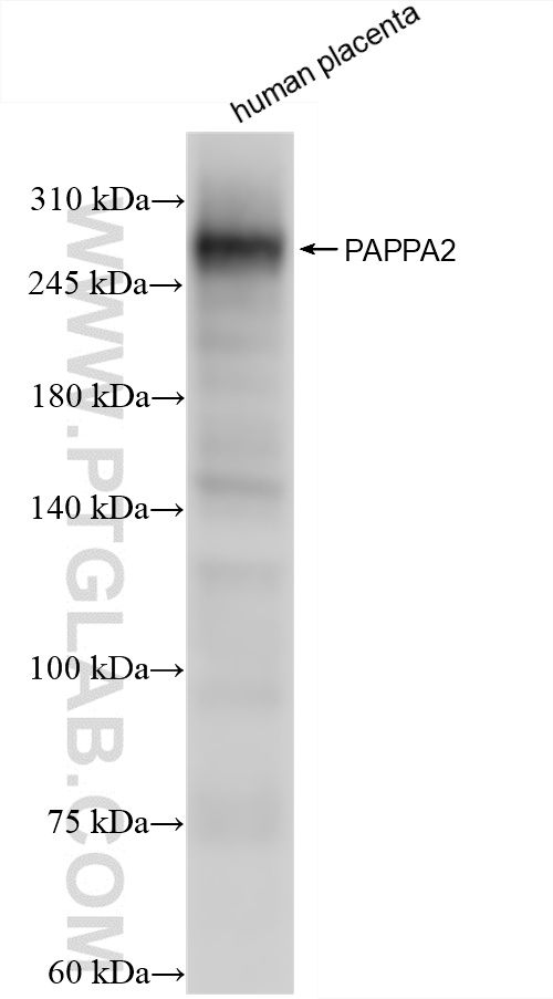 human placenta tissue were subjected to SDS PAGE followed by western blot with 85976-3-RR (PAPPA2 antibody) at dilution of 1:5000 incubated at room temperature for 1.5 hours. WB analysis of human placenta using 85976-3-RR
