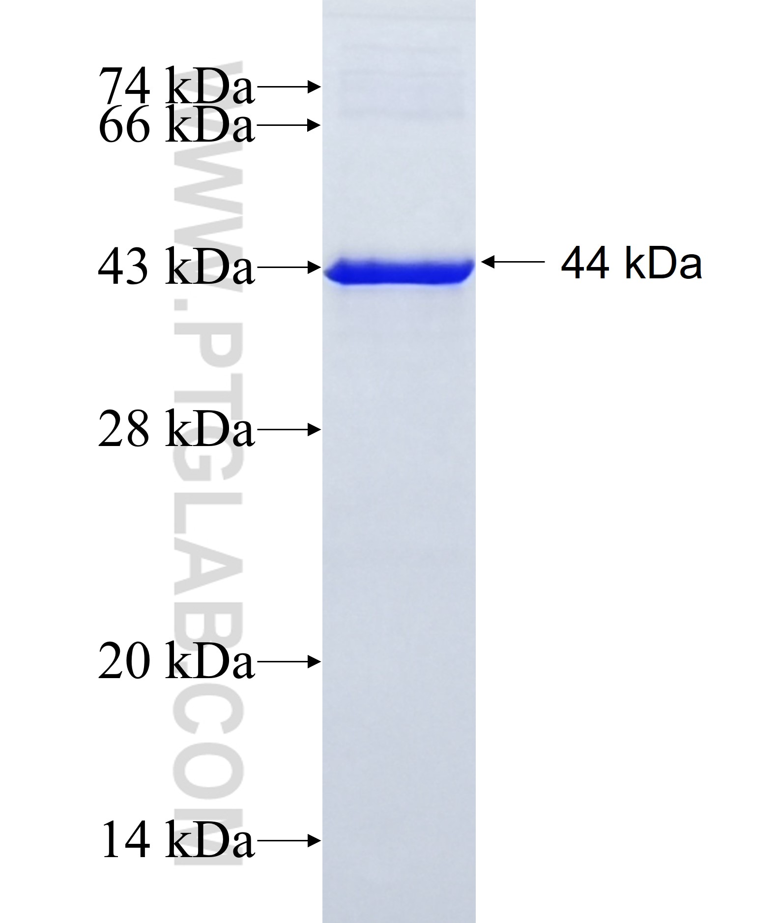 PAPPA fusion protein Ag11863 SDS-PAGE