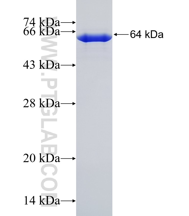 PAPPA2 fusion protein Ag31086 SDS-PAGE PAPPA2 fusion protein Ag31086 SDS-PAGE