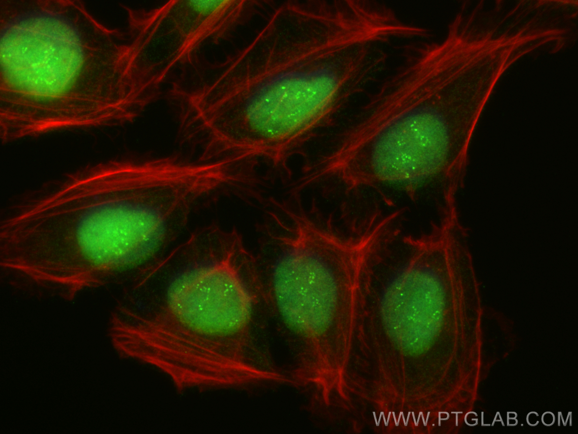 IF Staining of U2OS using 14708-1-AP