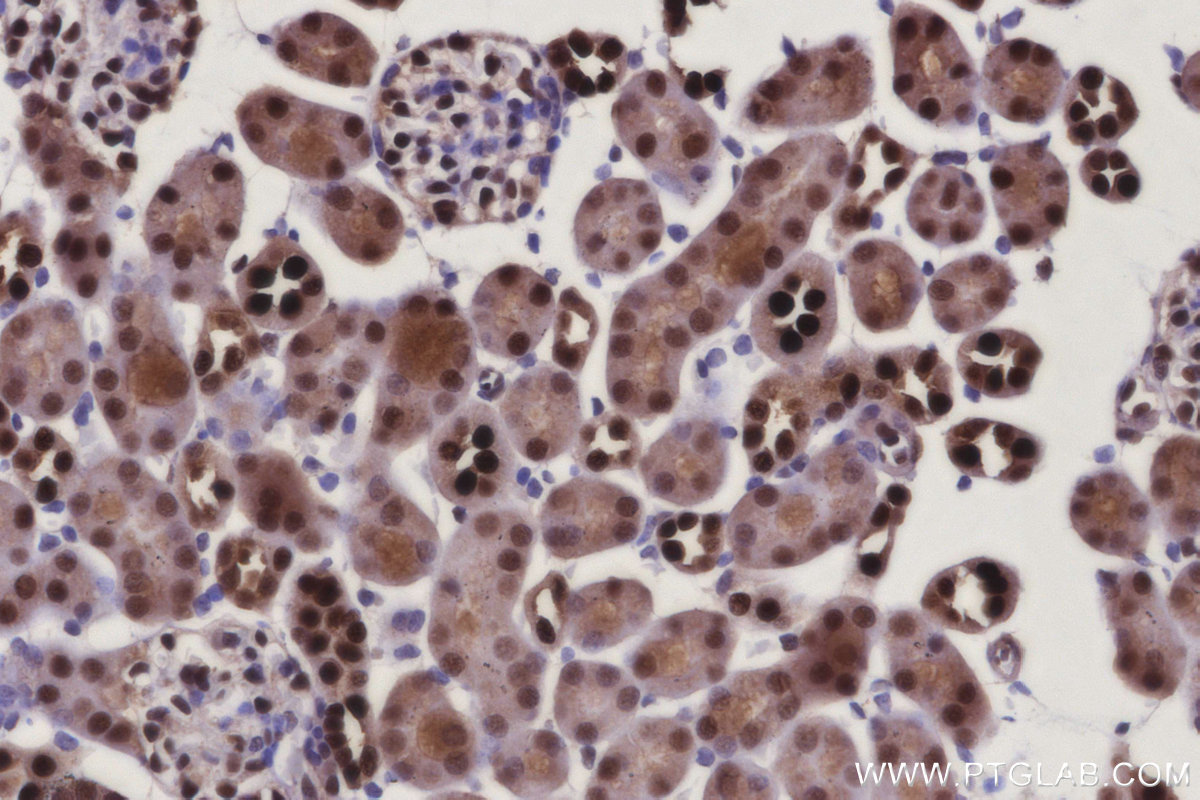 IHC staining of mouse kidney using 14708-1-AP IHC staining of mouse kidney using 14708-1-AP